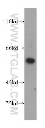 DGKE Antibody in Western Blot (WB)