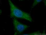 SCEL Antibody in Immunocytochemistry (ICC/IF)