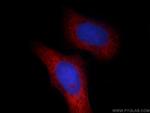 SCEL Antibody in Immunocytochemistry (ICC/IF)