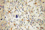 SCEL Antibody in Immunohistochemistry (Paraffin) (IHC (P))