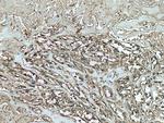 SCEL Antibody in Immunohistochemistry (Paraffin) (IHC (P))