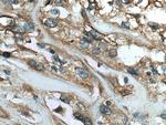 SCEL Antibody in Immunohistochemistry (Paraffin) (IHC (P))