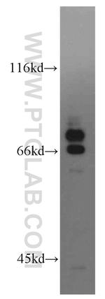 SCEL Antibody in Western Blot (WB)