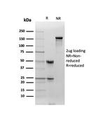 Clusterin/Apolipoprotein J (APO-J) Antibody in SDS-PAGE (SDS-PAGE)