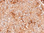 Clusterin/Apolipoprotein J (APO-J) Antibody in Immunohistochemistry (Paraffin) (IHC (P))