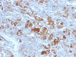 Clusterin/Apolipoprotein J (APO-J) Monoclonal Antibody (CLU, 4731)