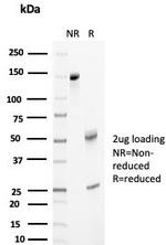 Clusterin/Apolipoprotein J (APO-J) Antibody in SDS-PAGE (SDS-PAGE)