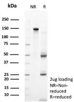 Clusterin/Apolipoprotein J (APO-J) Antibody in SDS-PAGE (SDS-PAGE)