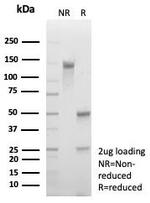 Clusterin/Apolipoprotein J (APO-J) Antibody in SDS-PAGE (SDS-PAGE)