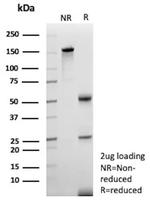 Clusterin/Apolipoprotein J (APO-J) Antibody in SDS-PAGE (SDS-PAGE)