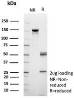 Clusterin/Apolipoprotein J (APO-J) Antibody in SDS-PAGE (SDS-PAGE)