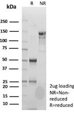 Clusterin/Apolipoprotein J (APO-J) Antibody in SDS-PAGE (SDS-PAGE)