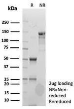 Clusterin/Apolipoprotein J (APO-J) Antibody in SDS-PAGE (SDS-PAGE)