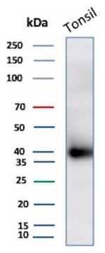 Clusterin/Apolipoprotein J (APO-J) Antibody in Western Blot (WB)