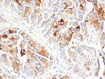 Clusterin/Apolipoprotein J (APO-J) Monoclonal Antibody (CLU/4723)
