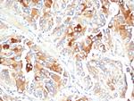Clusterin/Apolipoprotein J (APO-J) Monoclonal Antibody (CLU/4723)