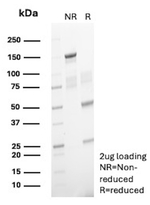 Clusterin/Apolipoprotein J (APO-J) (Marker of Anaplastic Large Cell Lymphoma) Antibody in SDS-PAGE (SDS-PAGE)