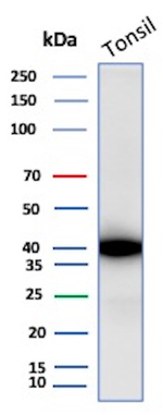 Clusterin/Apolipoprotein J (APO-J) (Marker of Anaplastic Large Cell Lymphoma) Antibody in Western Blot (WB)