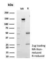 Clusterin/Apolipoprotein J (APO-J) Antibody in SDS-PAGE (SDS-PAGE)