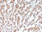 Clusterin/Apolipoprotein J (APO-J) Monoclonal Antibody (CLU/4729)