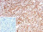 Clusterin/Apolipoprotein J (APO-J) Recombinant Rabbit Monoclonal Antibody (CLU/8865R)