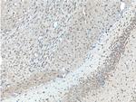 GPR125 Antibody in Immunohistochemistry (Paraffin) (IHC (P))