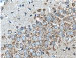 GPR125 Antibody in Immunohistochemistry (Paraffin) (IHC (P))