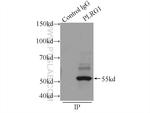 PLRG1 Antibody in Immunoprecipitation (IP)