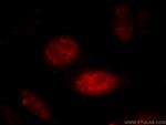 AGFG2 Antibody in Immunocytochemistry (ICC/IF)