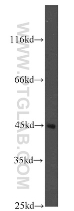 Kininogen 1 Antibody in Western Blot (WB)