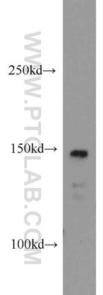 CSPP1 Antibody in Western Blot (WB)