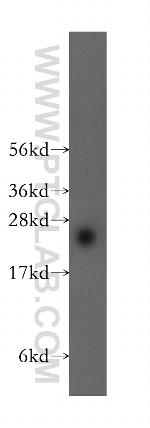 ARL15 Antibody in Western Blot (WB)