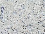 Cyclin E2 Antibody in Immunohistochemistry (Paraffin) (IHC (P))