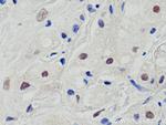 Cyclin E2 Antibody in Immunohistochemistry (Paraffin) (IHC (P))