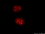 Cyclin E2 Antibody in Immunocytochemistry (ICC/IF)