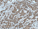 Cyclin E2 Antibody in Immunohistochemistry (Paraffin) (IHC (P))