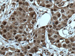 Cyclin E2 Antibody in Immunohistochemistry (Paraffin) (IHC (P))