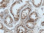 Cyclin E2 Antibody in Immunohistochemistry (Paraffin) (IHC (P))