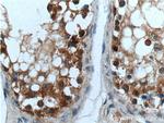Cyclin E2 Antibody in Immunohistochemistry (Paraffin) (IHC (P))