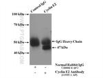 Cyclin E2 Antibody in Immunoprecipitation (IP)