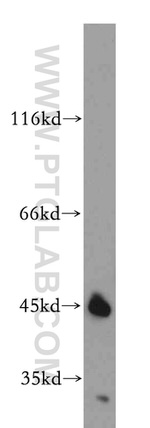 Beta sarcoglycan Antibody in Western Blot (WB)