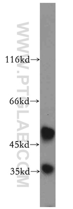 Beta sarcoglycan Antibody in Western Blot (WB)