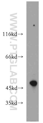 Beta sarcoglycan Antibody in Western Blot (WB)