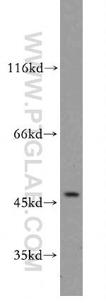 Beta sarcoglycan Antibody in Western Blot (WB)