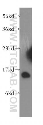MAPKSP1 Antibody in Western Blot (WB)