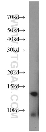 MAPKSP1 Antibody in Western Blot (WB)