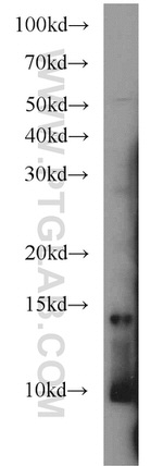 MAPKSP1 Antibody in Western Blot (WB)