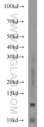 MAPKSP1 Antibody in Western Blot (WB)