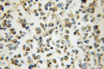 ARHGAP15 Antibody in Immunohistochemistry (Paraffin) (IHC (P))