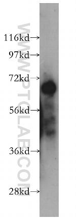 ARHGAP15 Antibody in Western Blot (WB)